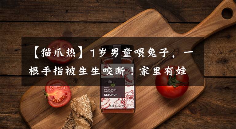 【猫爪热】1岁男童喂兔子,一根手指被生生咬断!家里有娃,养宠物要当心