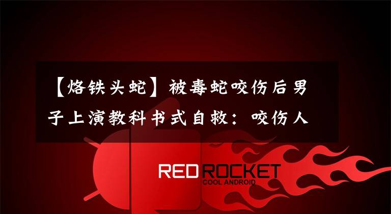 【烙铁头蛇】被毒蛇咬伤后男子上演教科书式自救:咬伤人的烙铁头蛇有多毒?