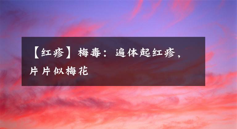 【红疹】梅毒：遍体起红疹，片片似梅花