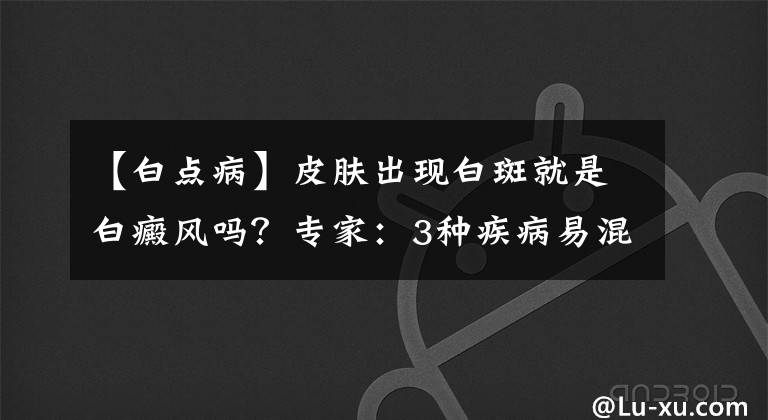 【白点病】皮肤出现白斑就是白癜风吗?专家:3种疾病易混淆