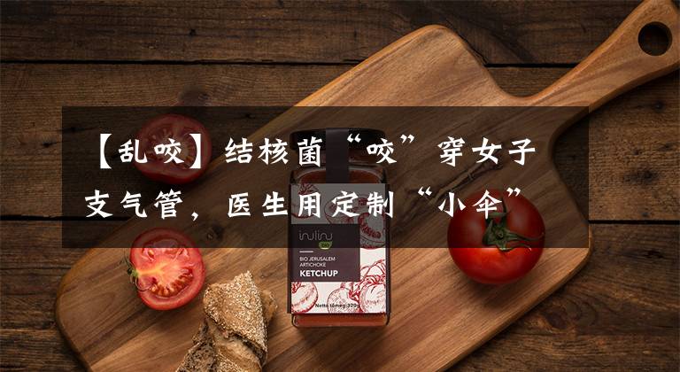 【乱咬】结核菌“咬”穿女子支气管，医生用定制“小伞”封堵漏洞