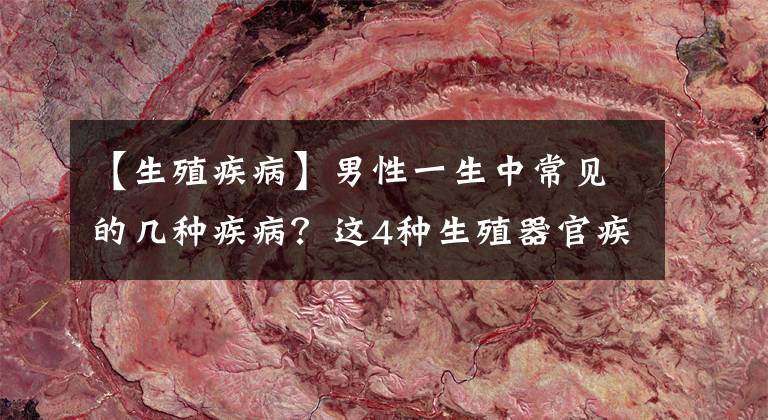 【生殖疾病】男性一生中常见的几种疾病？这4种生殖器官疾病最多见！希望你没有