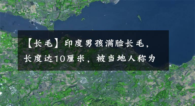 【长毛】印度男孩满脸长毛，长度达10厘米，被当地人称为狼人