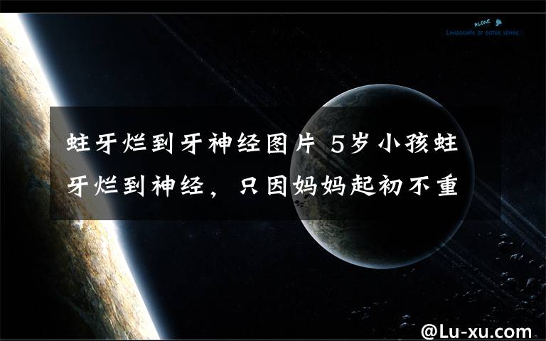 蛀牙烂到牙神经图片 5岁小孩蛀牙烂到神经，只因妈妈起初不重视