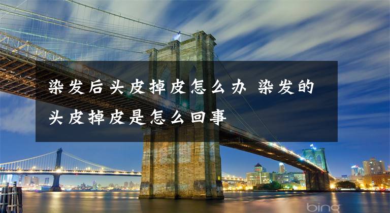 染发后头皮掉皮怎么办 染发的头皮掉皮是怎么回事