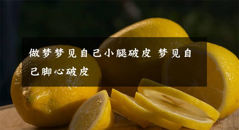 做梦梦见自己小腿破皮 梦见自己脚心破皮